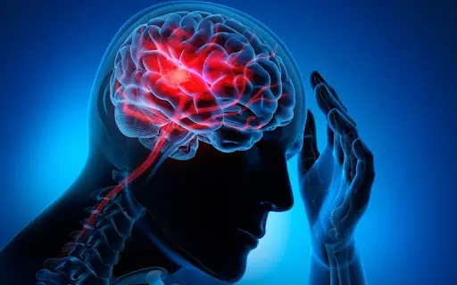 Tổng quan về tai biến mạch máu não – cách sơ cứu và điều trị