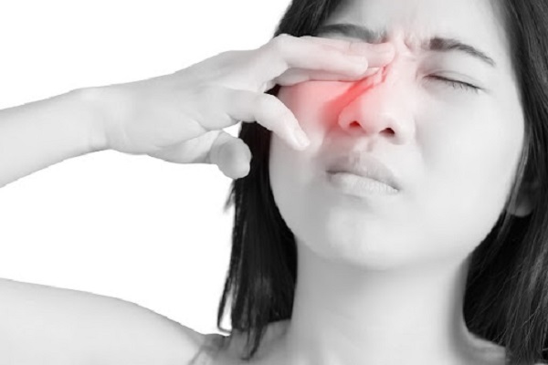 Viêm xoang cấp có thể gây mù mắt đột ngột