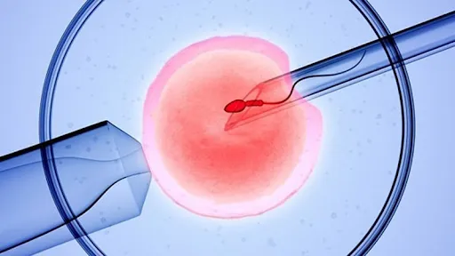 Tỷ lệ nang trứng non cao vẫn có thể điều trị được nhờ IVM
