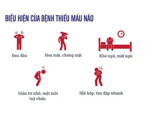 Dấu hiệu thường gặp của bệnh thiếu máu não